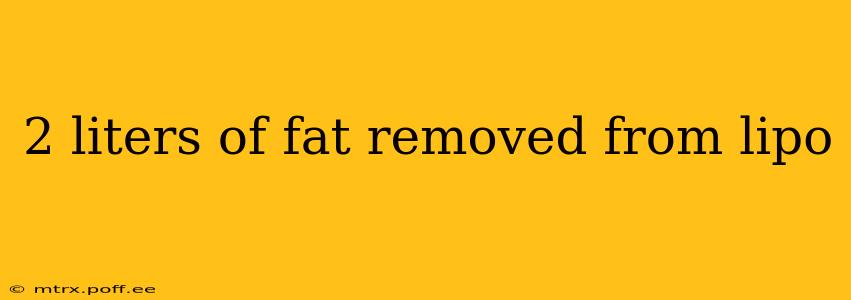 2 liters of fat removed from lipo