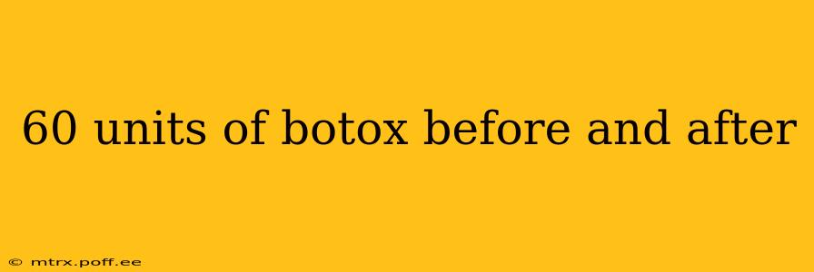 60 units of botox before and after