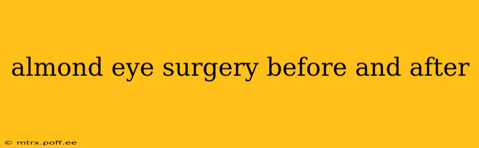almond eye surgery before and after