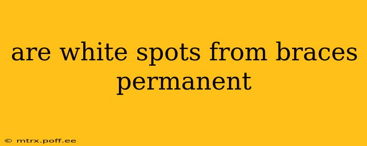 are white spots from braces permanent