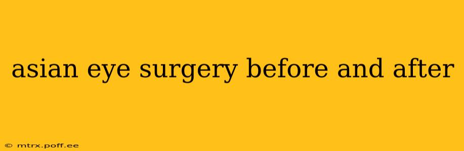 asian eye surgery before and after