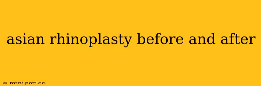 asian rhinoplasty before and after