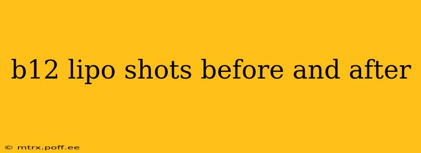 b12 lipo shots before and after