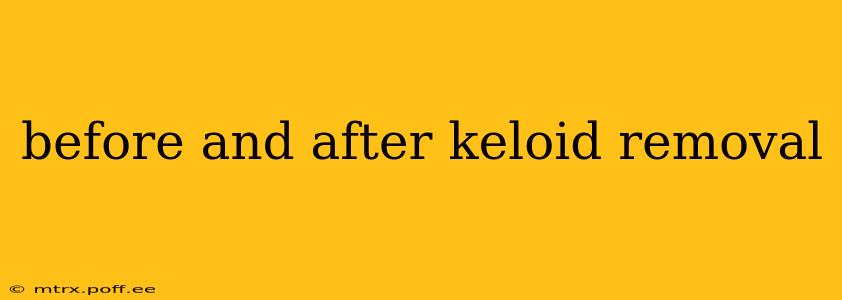 before and after keloid removal