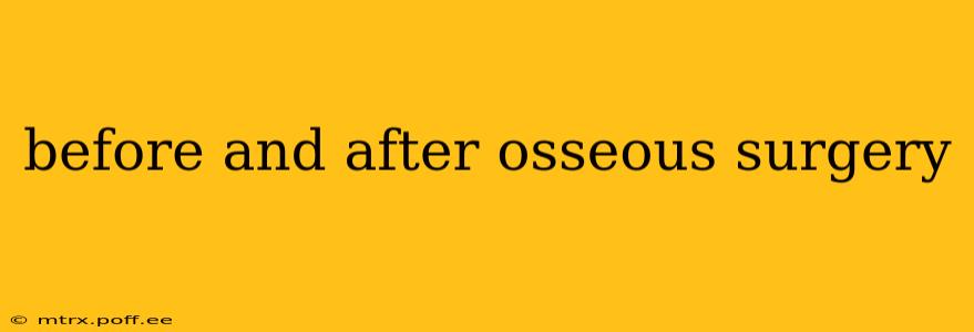 before and after osseous surgery