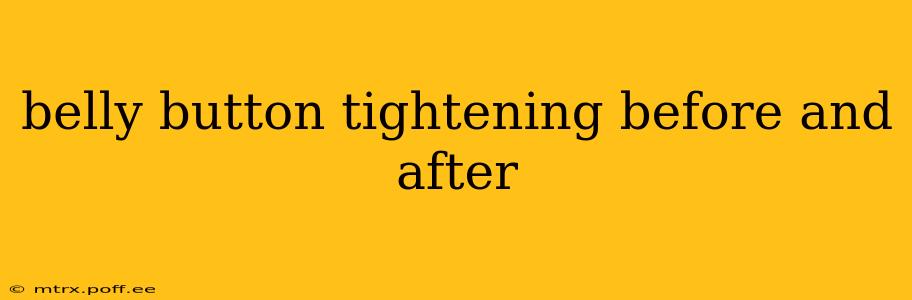 belly button tightening before and after
