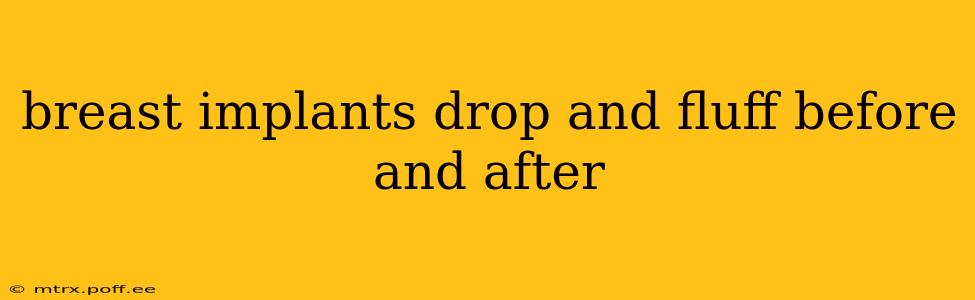 breast implants drop and fluff before and after