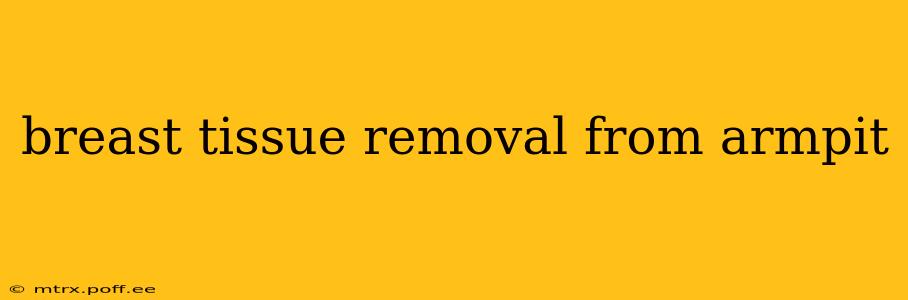 breast tissue removal from armpit