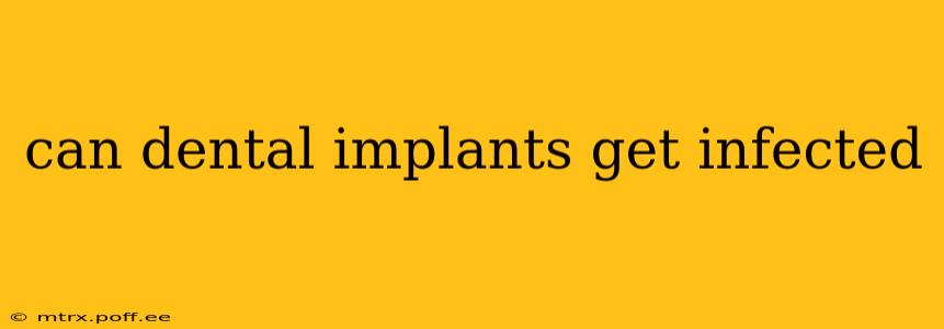can dental implants get infected