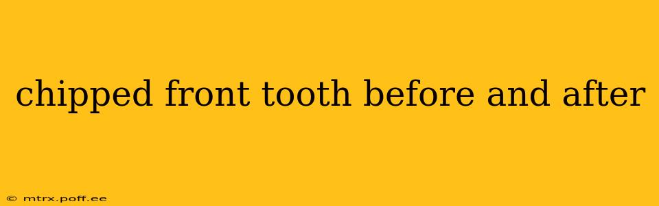chipped front tooth before and after