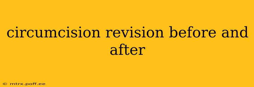 circumcision revision before and after