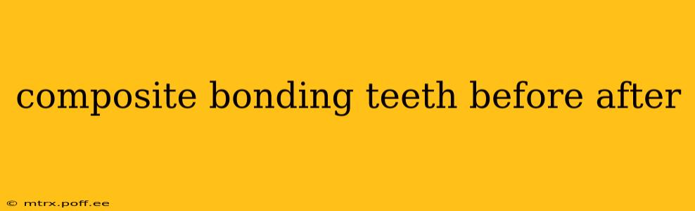 composite bonding teeth before after