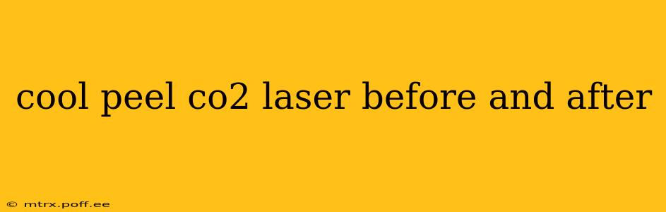 cool peel co2 laser before and after