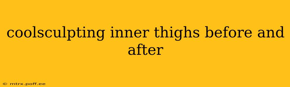 coolsculpting inner thighs before and after