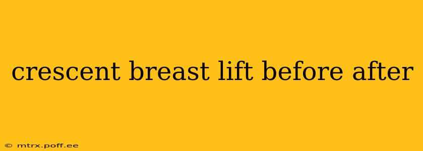 crescent breast lift before after