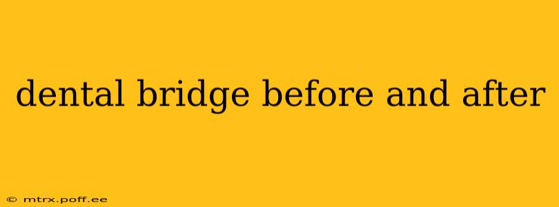 dental bridge before and after
