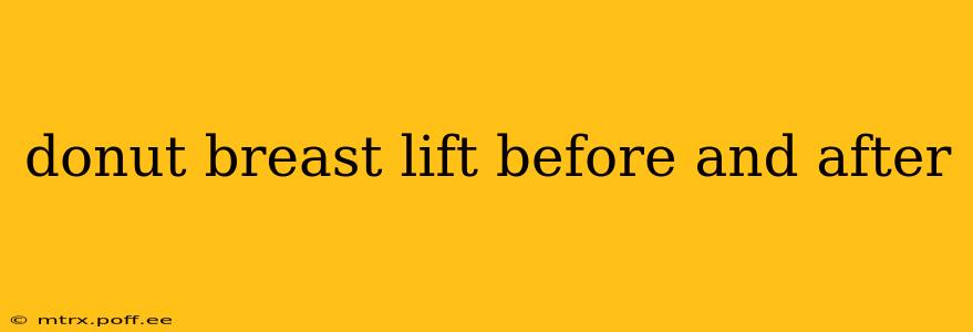 donut breast lift before and after