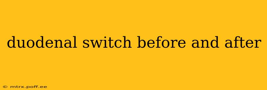 duodenal switch before and after