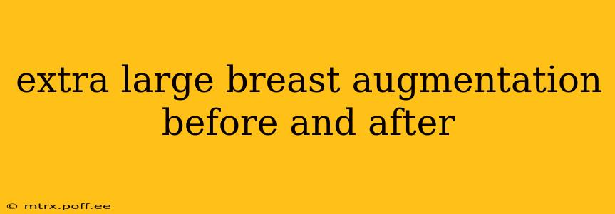 extra large breast augmentation before and after