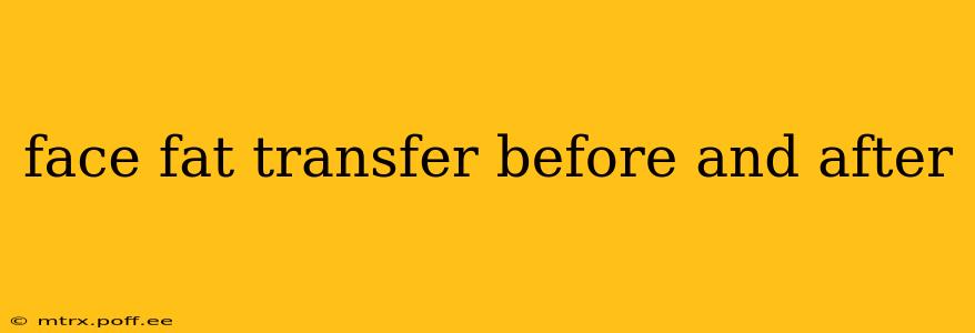 face fat transfer before and after