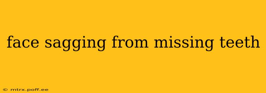face sagging from missing teeth