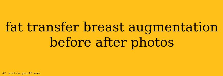 fat transfer breast augmentation before after photos