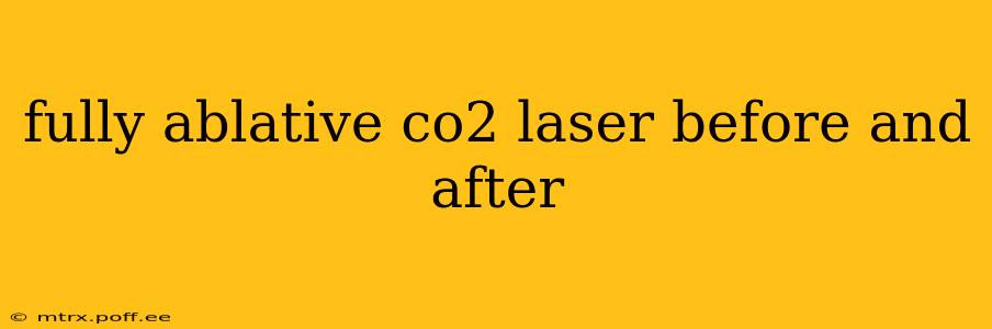 fully ablative co2 laser before and after