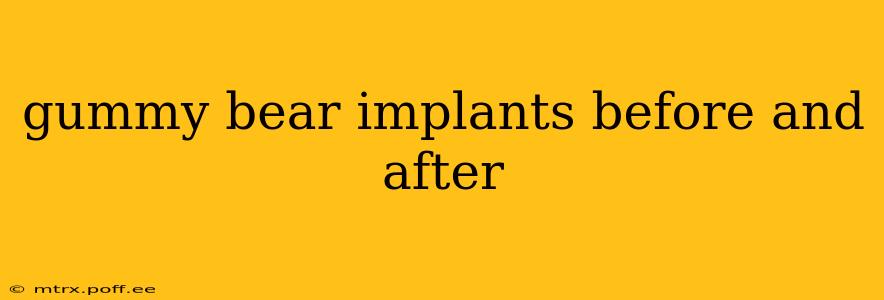 gummy bear implants before and after