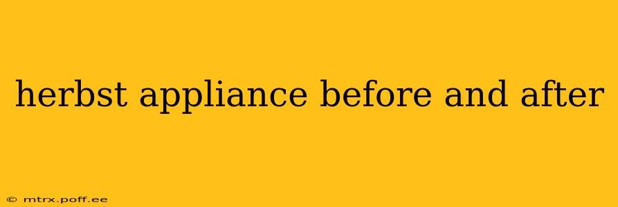 herbst appliance before and after