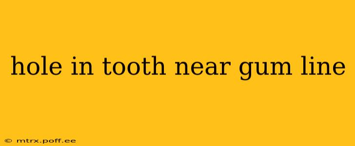 hole in tooth near gum line