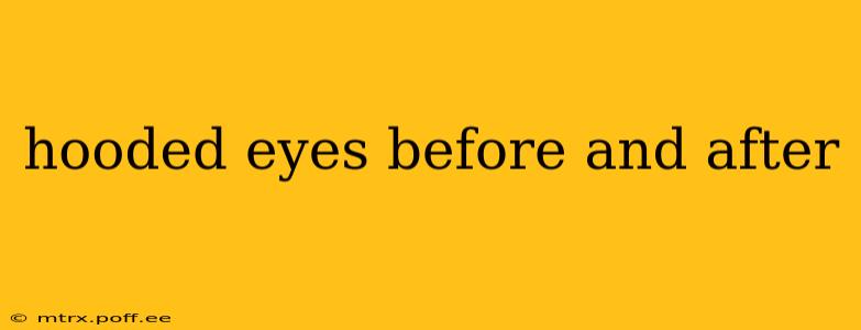 hooded eyes before and after