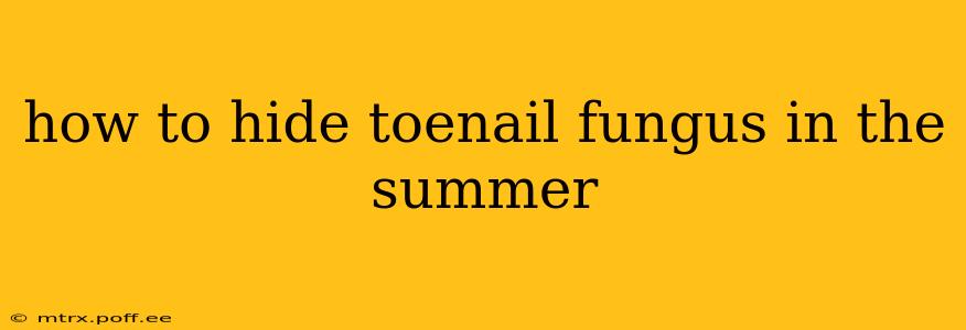 how to hide toenail fungus in the summer