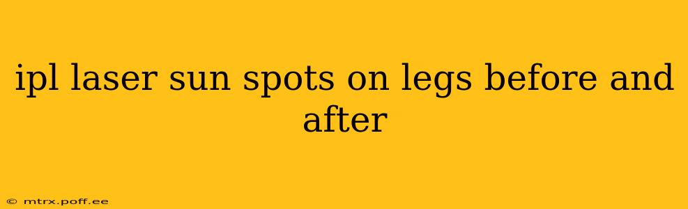 ipl laser sun spots on legs before and after