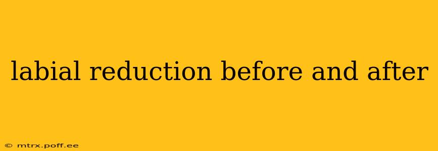 labial reduction before and after