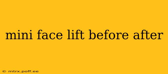 mini face lift before after