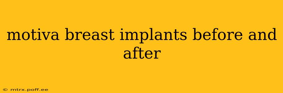 motiva breast implants before and after