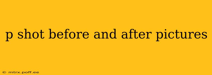 p shot before and after pictures
