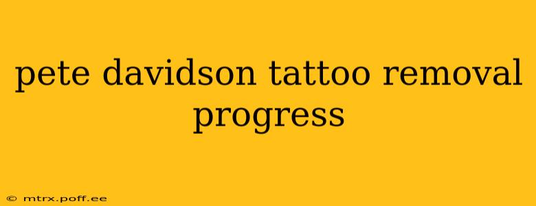 pete davidson tattoo removal progress