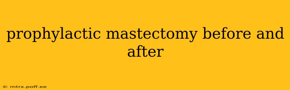 prophylactic mastectomy before and after