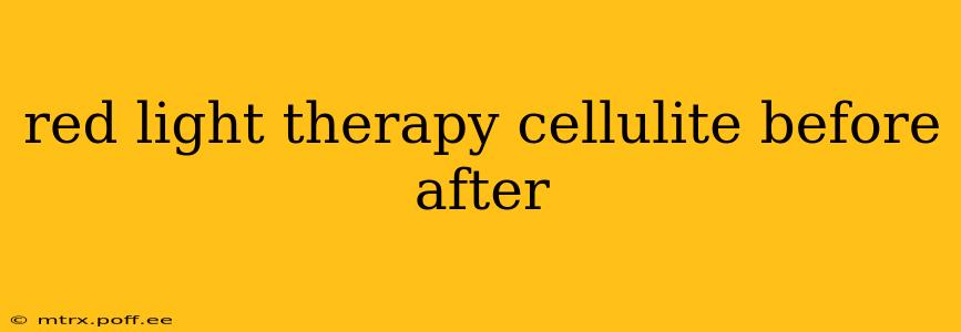 red light therapy cellulite before after