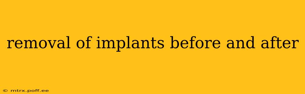 removal of implants before and after