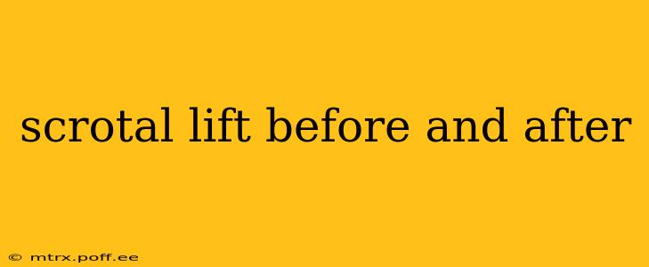 scrotal lift before and after