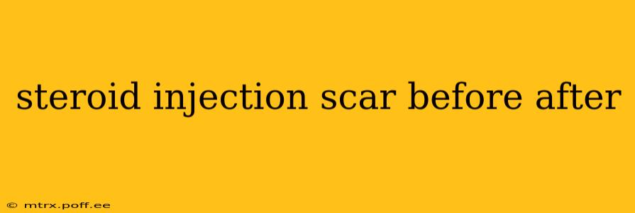 steroid injection scar before after