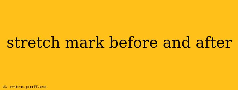 stretch mark before and after