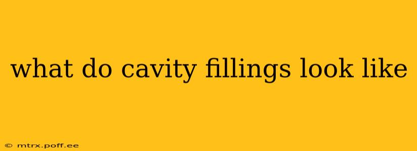 what do cavity fillings look like