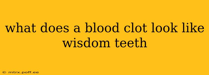 what does a blood clot look like wisdom teeth