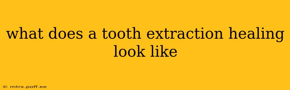 what does a tooth extraction healing look like