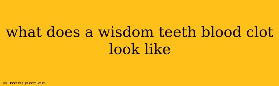 what does a wisdom teeth blood clot look like