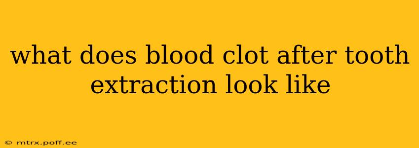 what does blood clot after tooth extraction look like