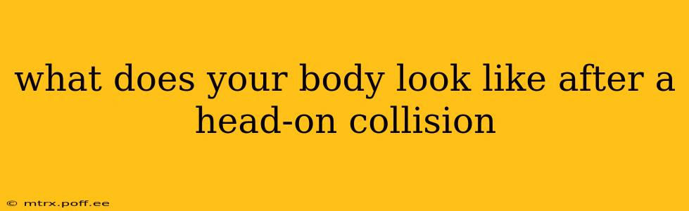 what does your body look like after a head-on collision